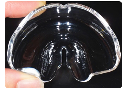 マウスピース写真5