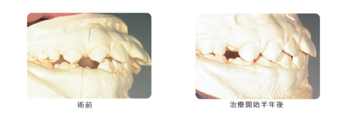 マウスピース写真7